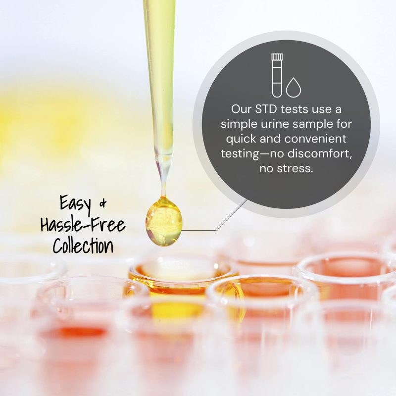 Common STD Test - Image 3